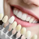 Esthetic Dentistry