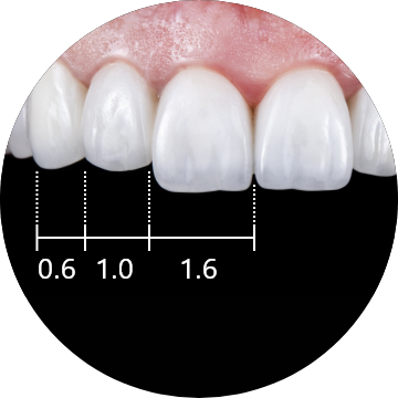 02 Relative Dental Proportions（歯の黄金分割）