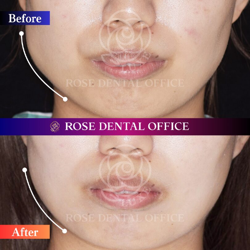 画像に alt 属性が指定されていません。ファイル名: 10%E3%81%AE%E3%82%B3%E3%83%94%E3%83%BC%E3%80%80.jpg